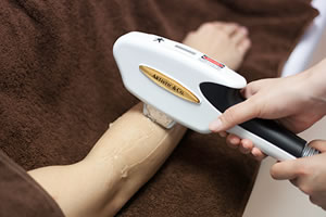 無料でテスト脱毛を行います